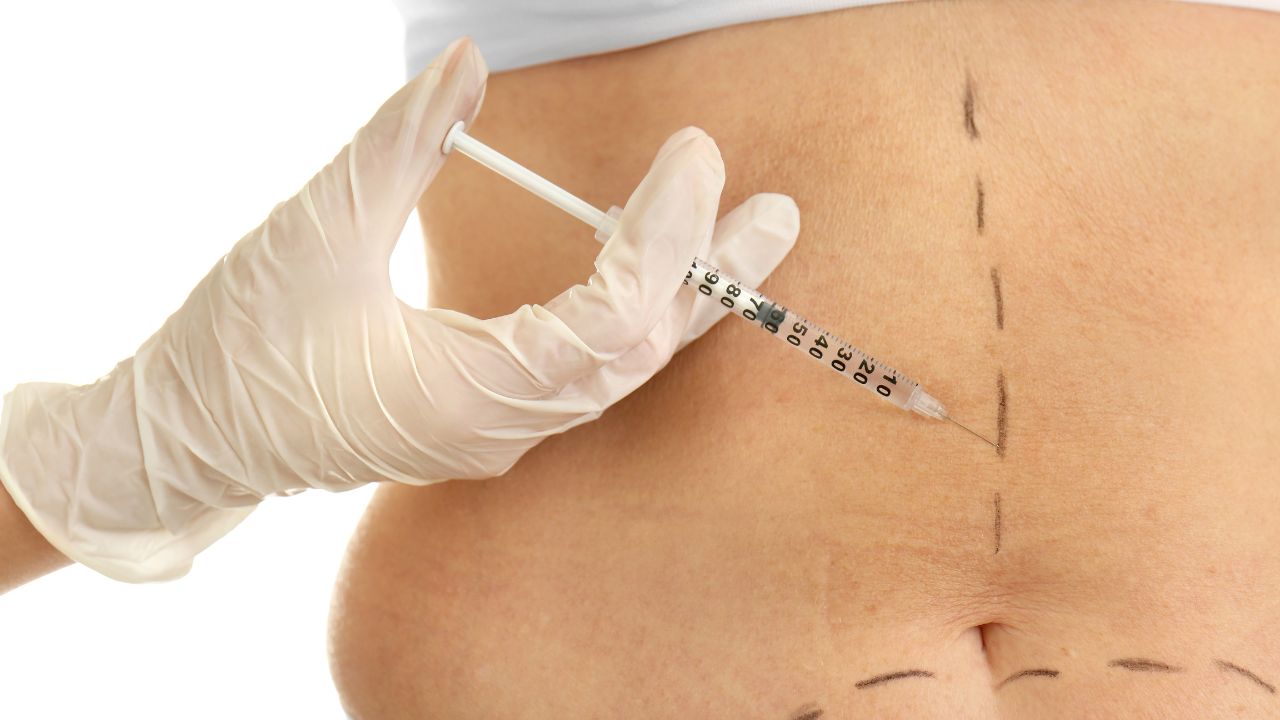 להשטיח את הבטן- איך עושים את זה?